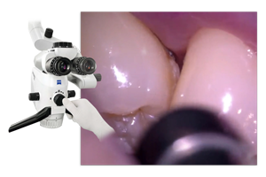 予防歯科の実践