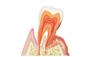 歯周病治療・口腔内環境の改善